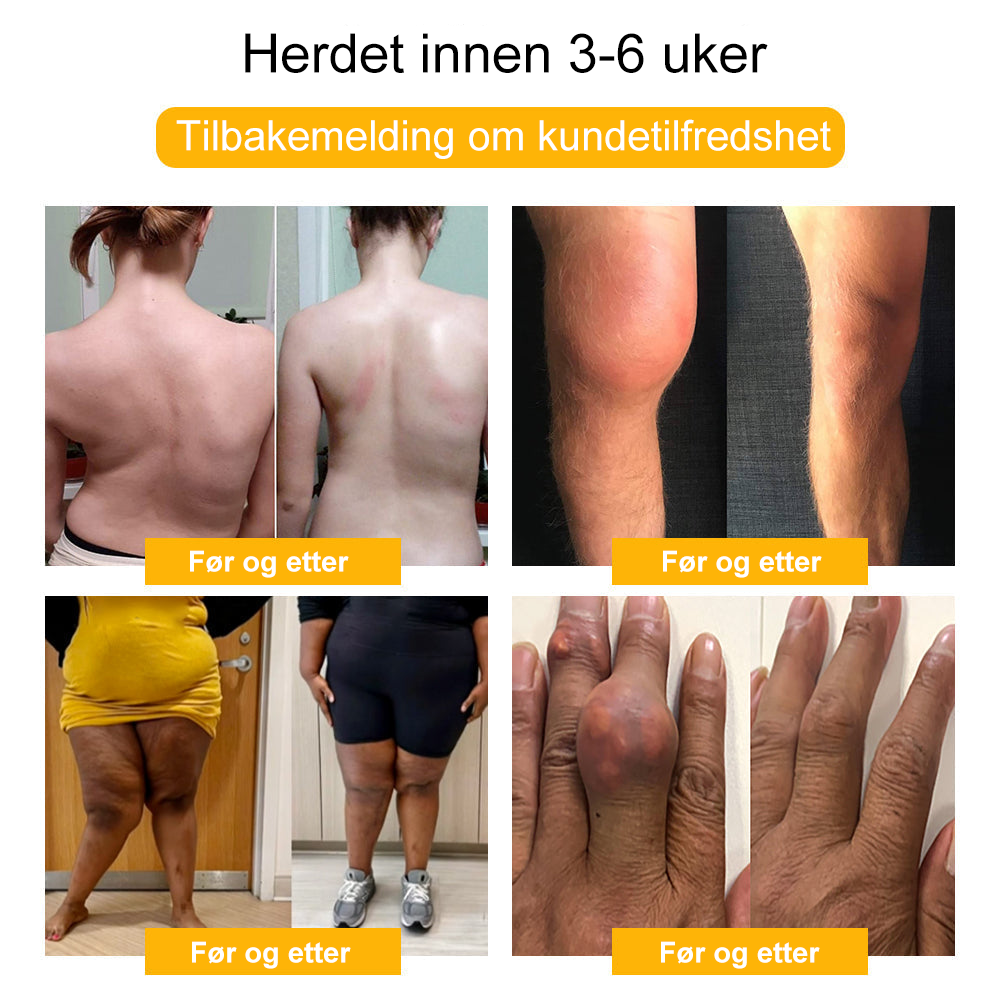 🏆🐝Vinartera™ Biegift Ledd Regenerasjons Krem🔥60 % rabatt i en begrenset periode🔥 -【CE-sertifisert】